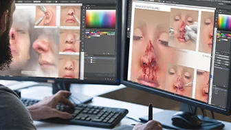 Medical Illustrations