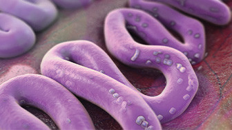 DigiStrip<sup>®</sup>