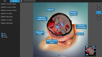 Diagnostic Slice Chooser®