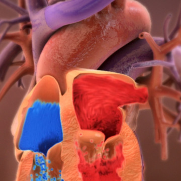 $8M Verdict: Animating Failure to Treat Heat Illness