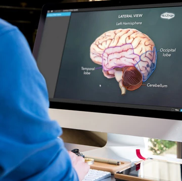 Brain injury presentation on monitor