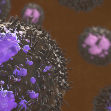 Confidential Settlement: Animating How Misdiagnosed Infection Caused Septic Shock