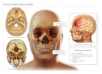 Facial Injuries & Head Trauma