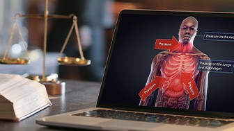 High Impact Creates Legal Animations and Medical Illustrations for George Floyd Trial