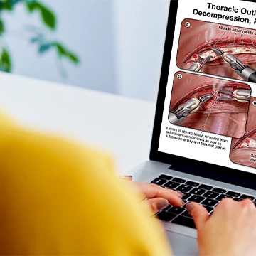Medical illustration on a laptop computer