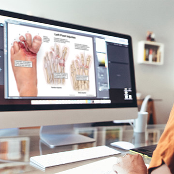 Medical illustrator working on a medical legal illustration showing severe foot injuries