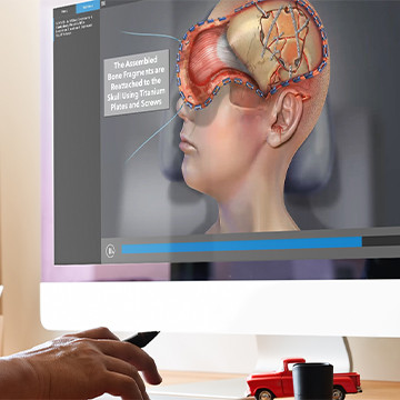 Diagnostic Slice Chooser on screen