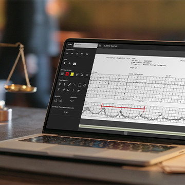 Digistrip - Fetal Monitor Presentation System