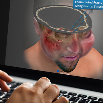 Interactive presentation of severe head injuries