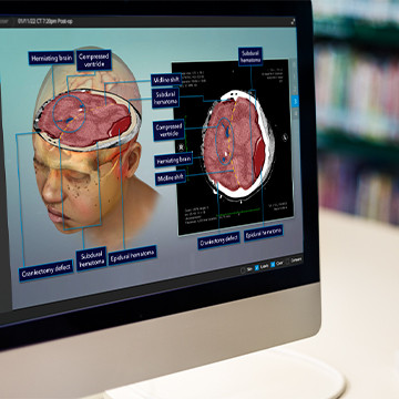 Diagnostic Slice Chooser on laptop