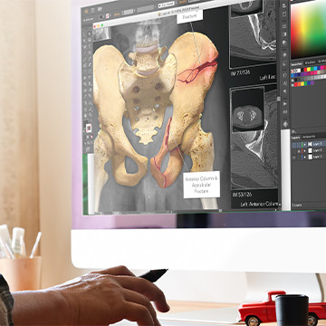 Medical illustrator working on a project
