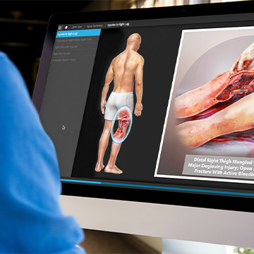 Digital injury summary presentation of severe leg injuries