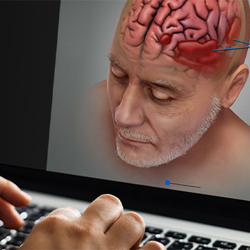 Diagnostic Slice Chooser