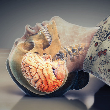 Head injury slip and fall