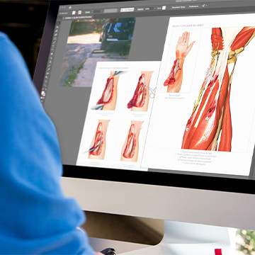 Medical illustration of severe forearm injuries