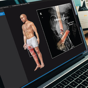 2D interactive presentation on laptop