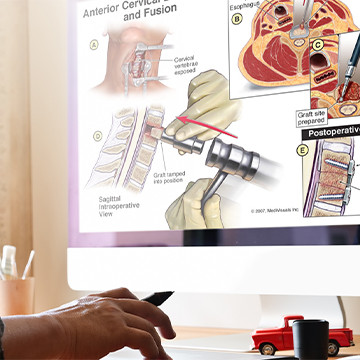Medical illustrator working on project