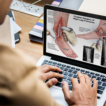 Medical illustration presentation