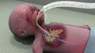 Premature Fetus: Lung Prematurity