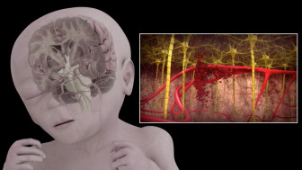 Premature Fetus: Neural Immaturity