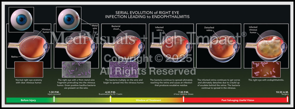 Serial Evolution of Right Eye Infection