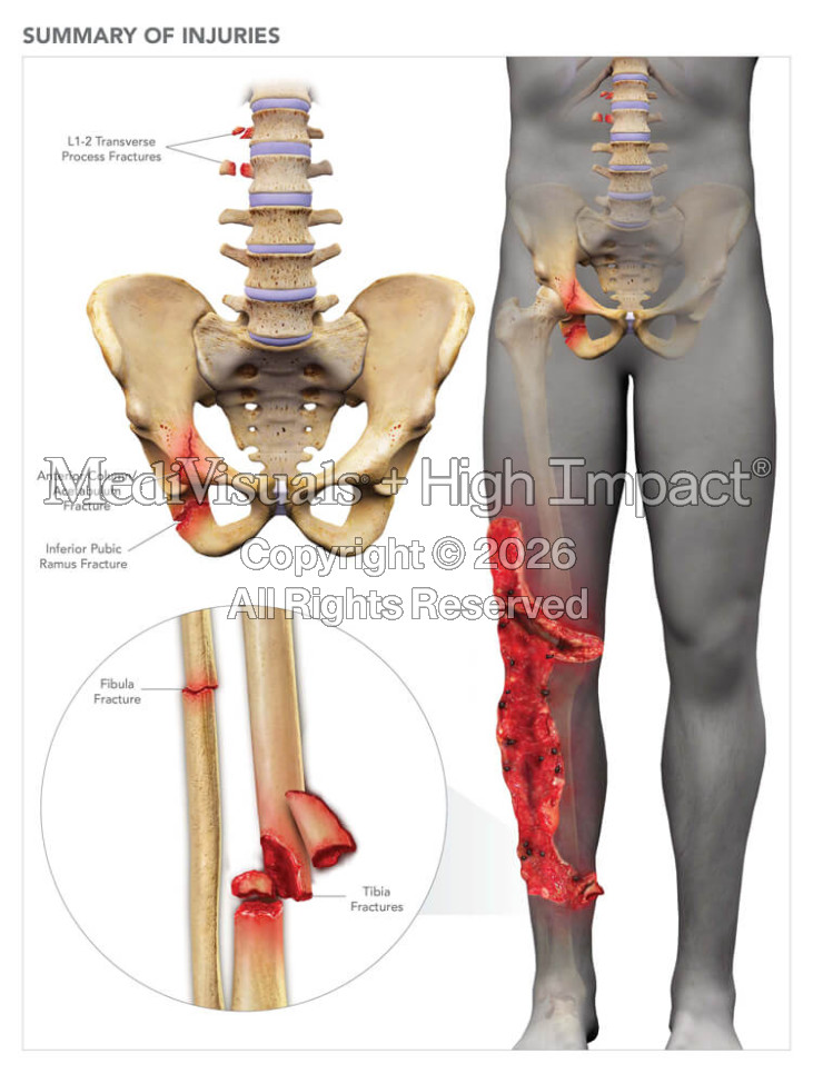 Summary of Injuries