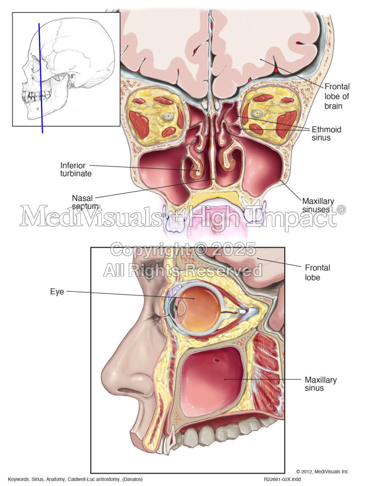 Cross-sectional Anatomy of Sinuses