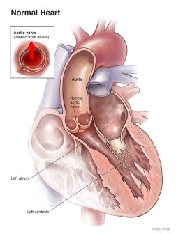 Normal Heart