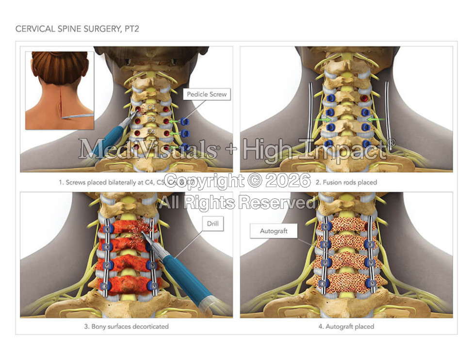 Top Types of Media Medical Illustration Companies Can Produce for Healthcare Organizations