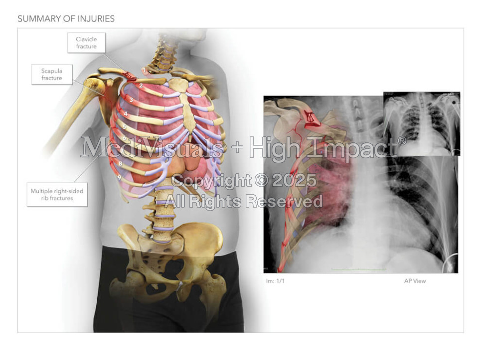Summary of Injuries