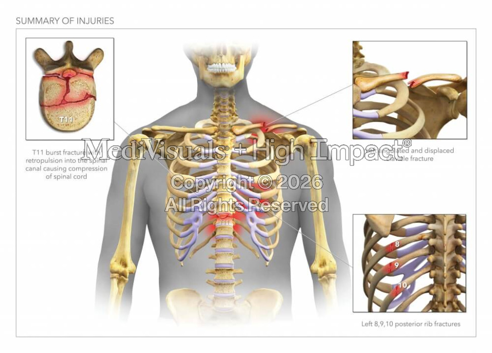 Summary of Injuries