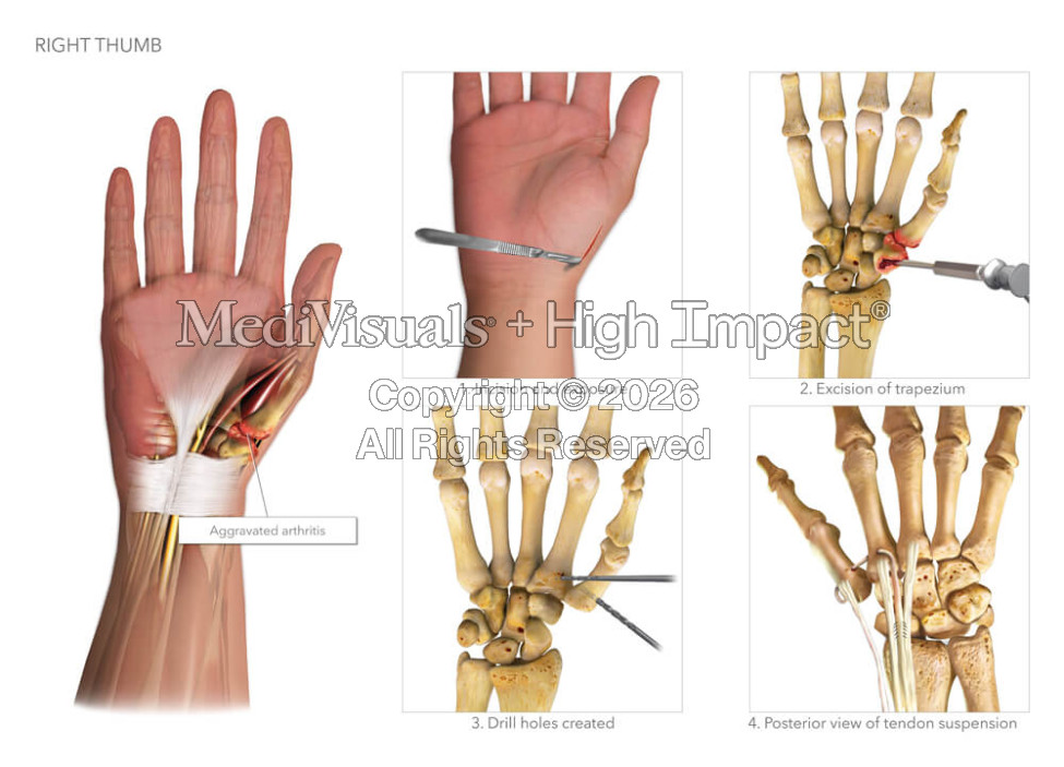 Right Thumb