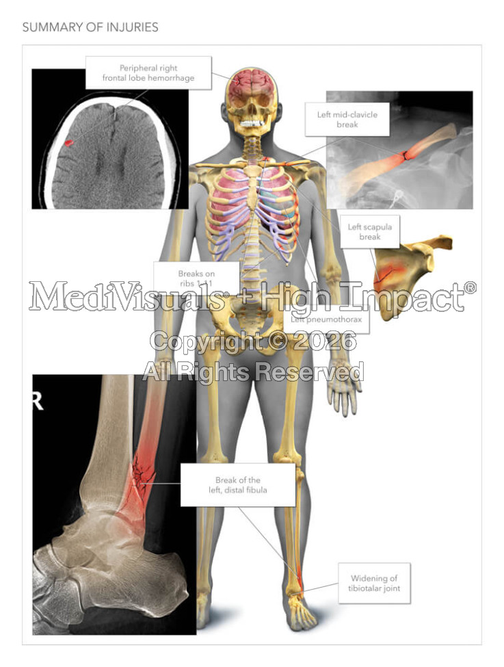 Summary of Injuries