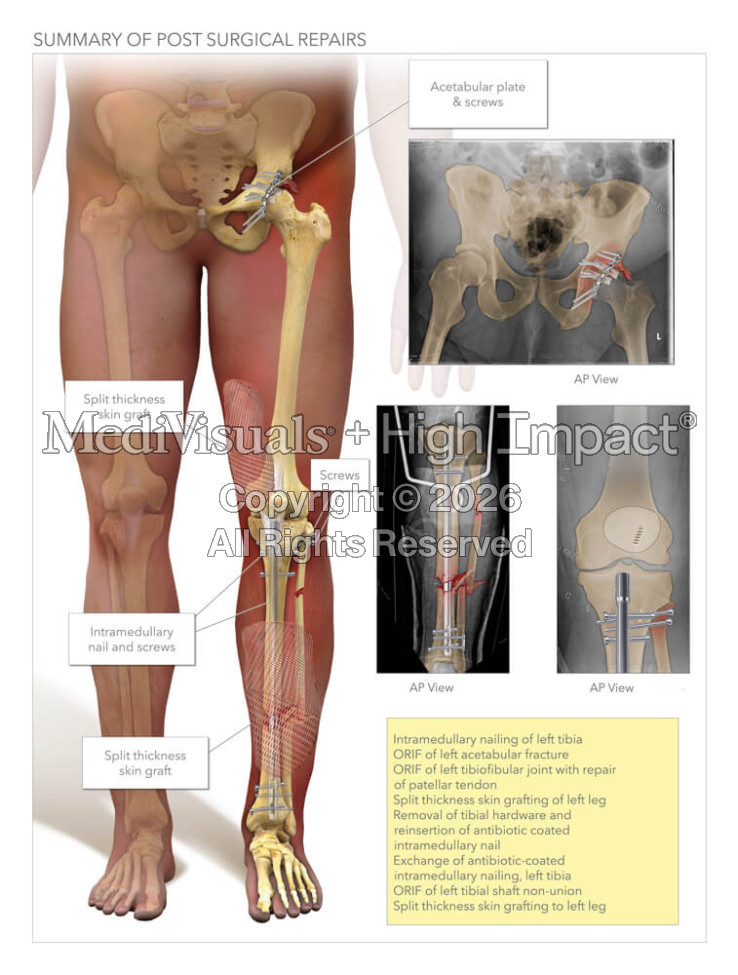 Summary of Post Surgical Repairs