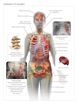 Summary of Injuries