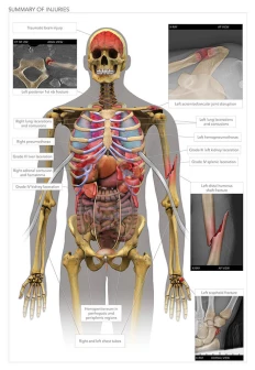 Summary of Injuries