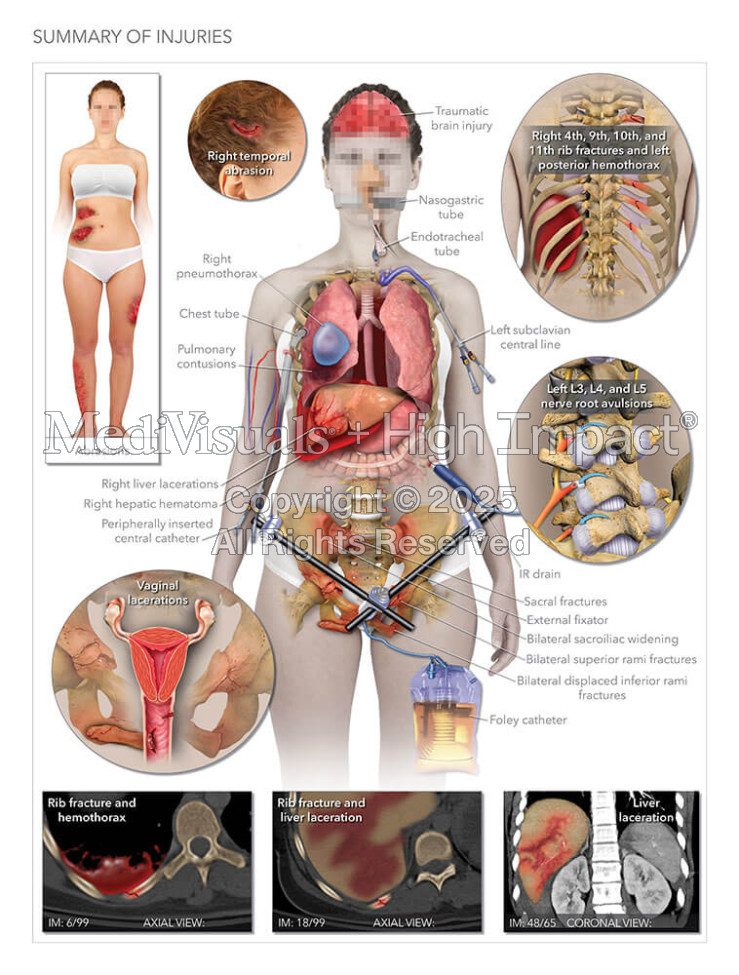 Summary of Injuries