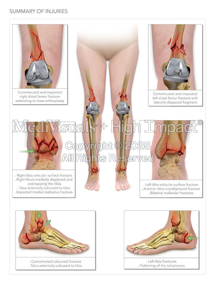 Summary of Injuries