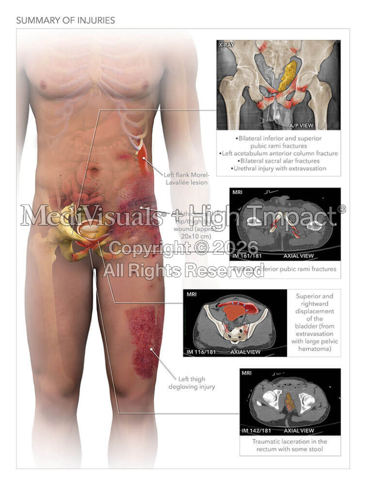 Summary of Injuries