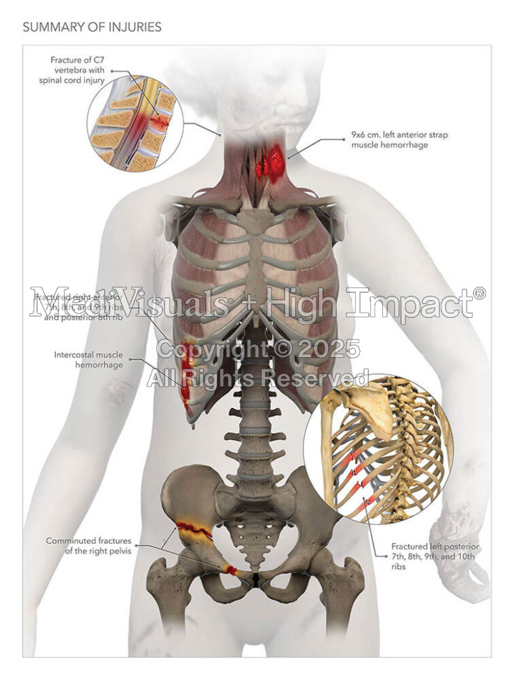 Summary of Injuries