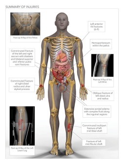 Summary of Injuries