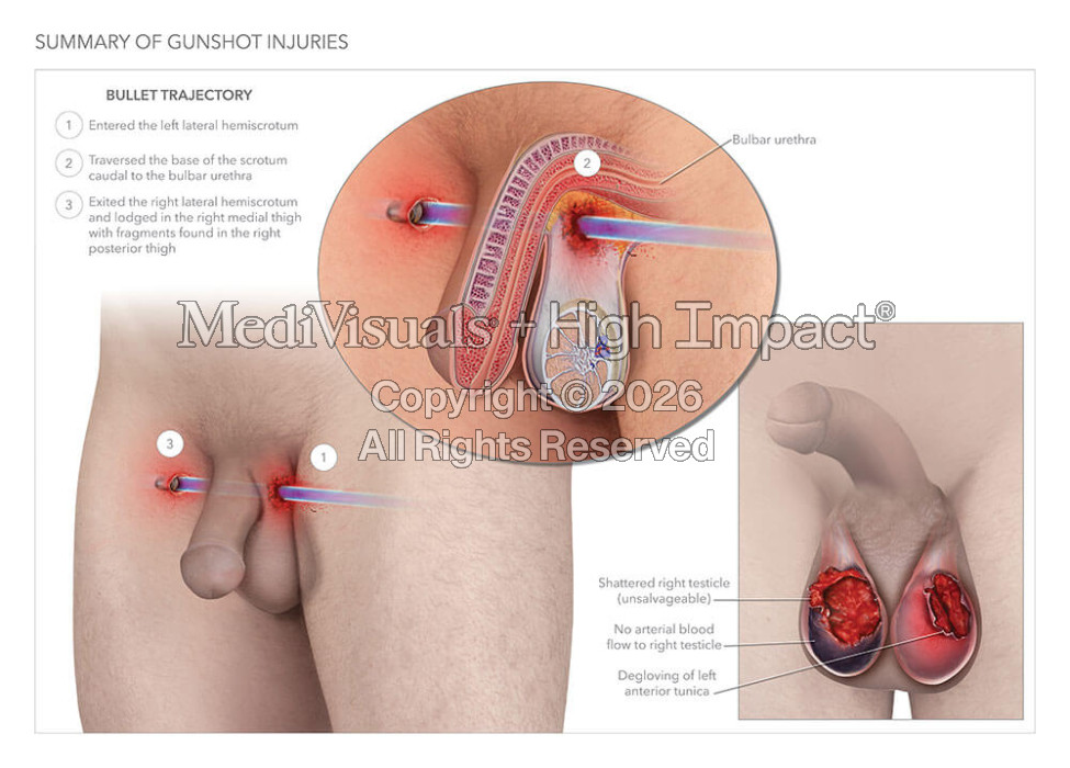 Summary of Gunshot Injuries