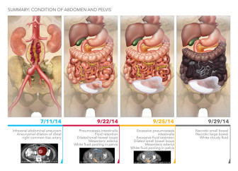 Summary: Condition of Abdomen and Pelvis
