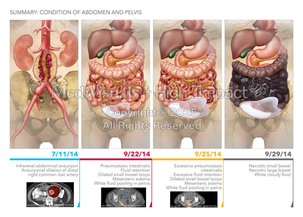Summary: Condition of Abdomen and Pelvis