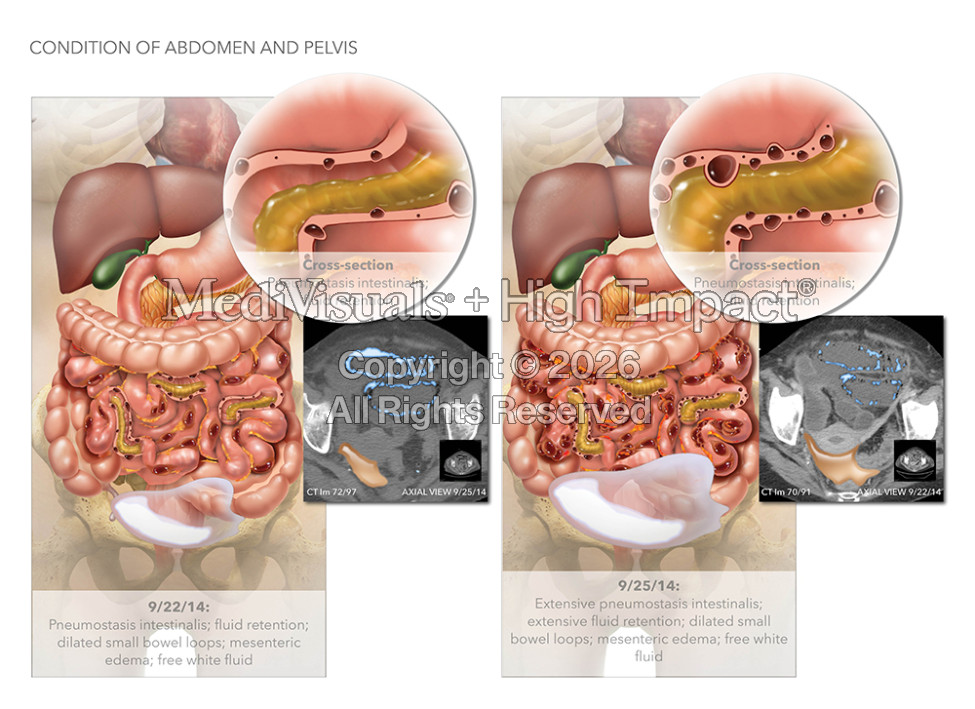 Condition of Abdomen and Pelvis