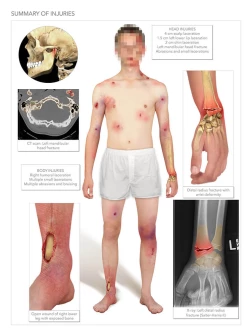 Summary of Injuries