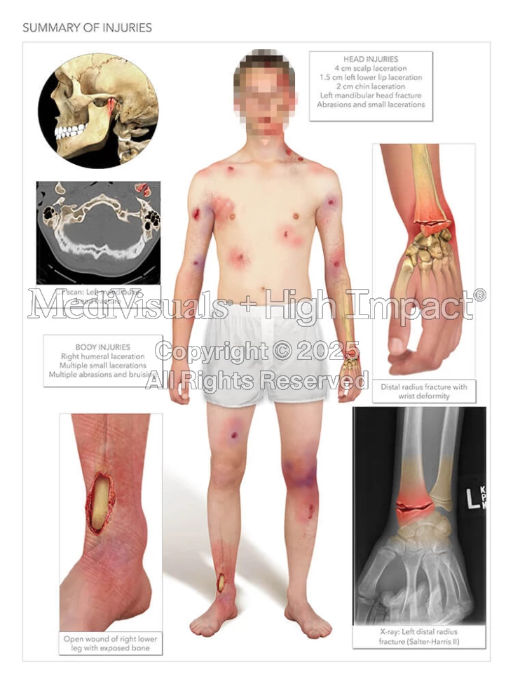 Injury Summary - Legal Graphics
