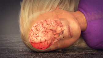 $3.75M Settlement: Animating Brain Injury After Swing Breaks from Swing Set
