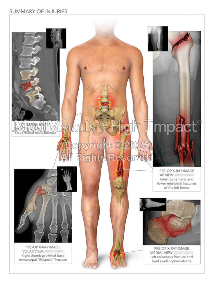 Summary of Injuries