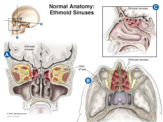 Normal Anatomy: Ethmoid Sinuses